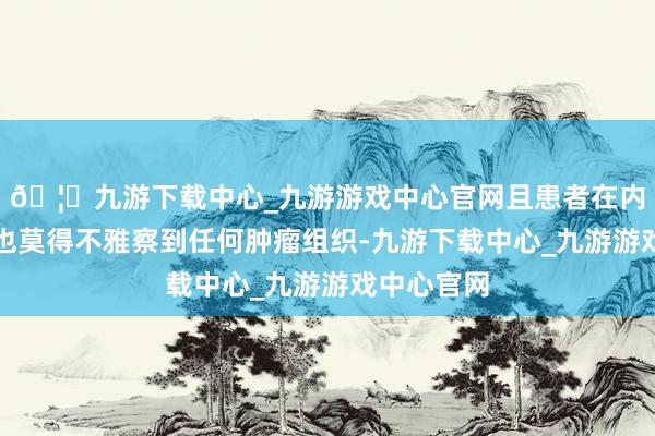 🦄九游下载中心_九游游戏中心官网且患者在内镜活检中也莫得不雅察到任何肿瘤组织-九游下载中心_九游游戏中心官网